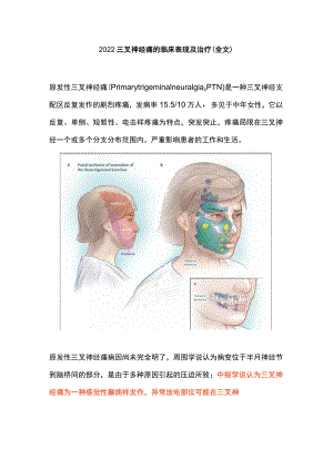 2022三叉神经痛的临床表现及治疗（全文）.docx