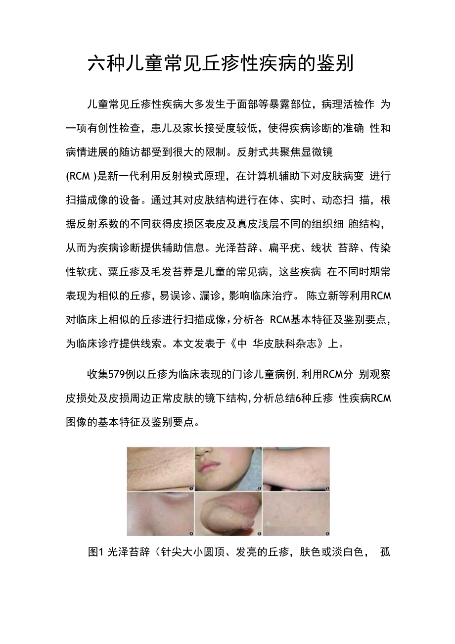 皮肤科科医师晋升副主任(主任)医师例分析专题报告(儿童常见丘疹性疾病).docx_第2页
