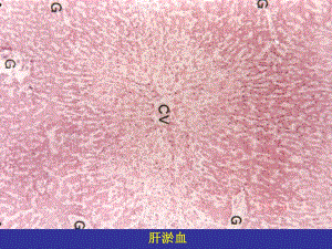 病理学实习镜下局部血液循环障碍.ppt