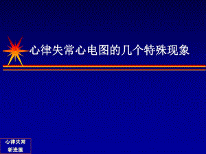 心律失常心电图的几个特殊现象名师编辑PPT课件.ppt