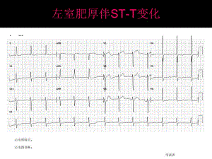 心电图考试完整.ppt