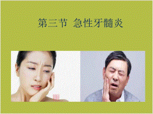 急性牙髓炎ppt课件.ppt