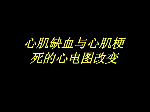 心肌缺血与心肌梗死的心电图改变.ppt