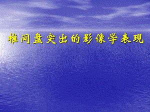 椎间盘突出的影像学表现.ppt