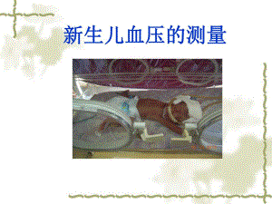 新生儿血压名师编辑PPT课件.ppt