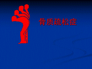 原发性骨质疏松.ppt