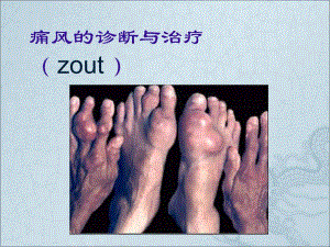 痛风的诊断与治疗讲课.ppt