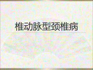 椎动脉型颈椎病.ppt