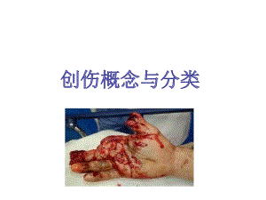 创伤概念与分类.ppt