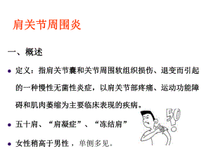 肩周炎ppt.ppt