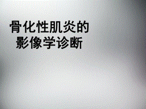 骨化性肌炎.ppt