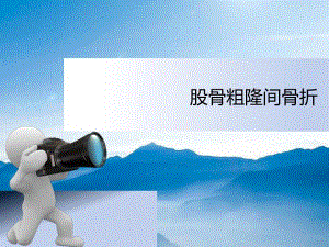 股骨粗隆间骨折围手术护理.ppt