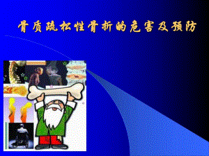 骨质疏松性骨折的危害及预防.ppt