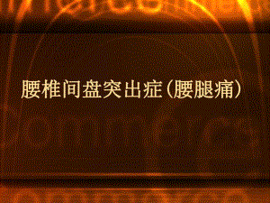 腰椎间盘突出症.ppt.ppt