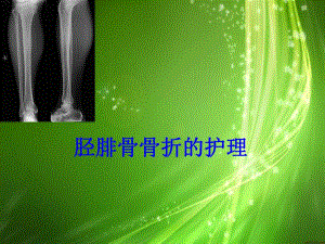 胫腓骨骨折的护理.ppt