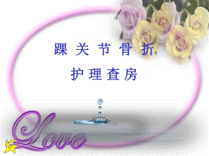 踝关节骨折护理查房.ppt