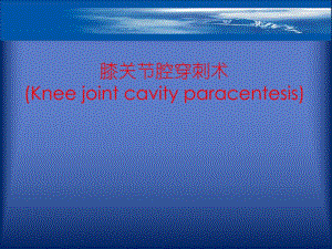 膝关节穿刺术.ppt