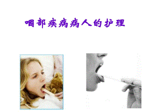 咽科病人的护理.ppt