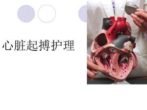 心脏起搏护理.ppt