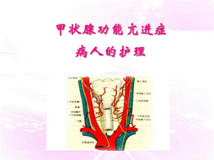 甲状腺功能亢进症病人的护理.ppt