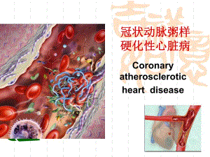 冠心病护理.ppt.ppt