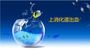 护理查房上消化道出血.ppt