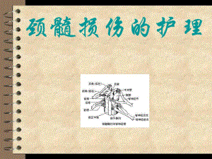 颈髓损伤的护理.ppt