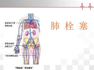肺栓塞诊疗及护理.ppt