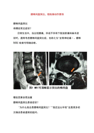 腰椎间盘突出锻炼操动作要领.docx