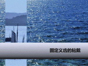 固定义齿粘戴.ppt