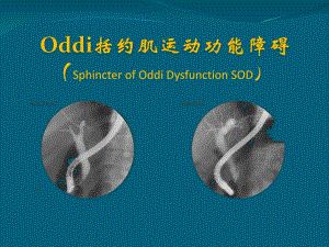 Oddi括约肌运动功能障碍.ppt