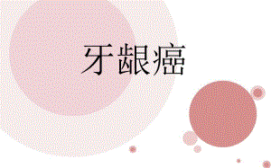 牙龈癌的护理.ppt