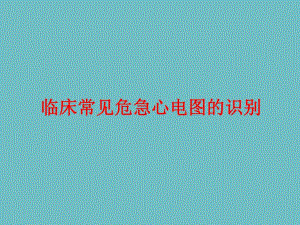 临床常见危急心电图的识别.ppt