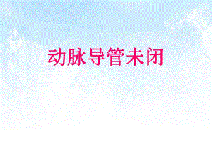 动脉导管未闭.ppt