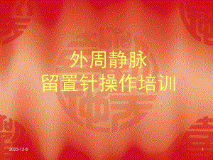 外周静脉留置针.ppt