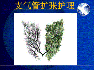 支气管扩张.ppt