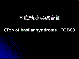基地动脉尖综合征.ppt