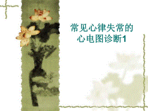 常见心律失常的心电图诊断1.ppt