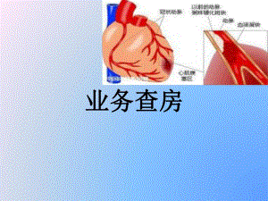扩张性心肌病.ppt