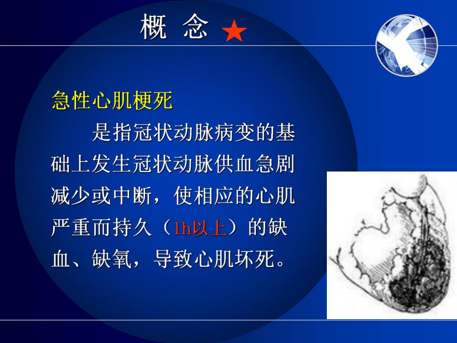 心肌梗死心肌梗塞心梗.ppt_第3页