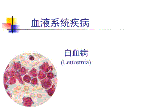 急性白血病.ppt