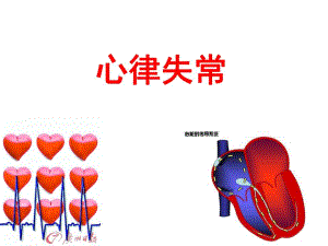 心律失常3.ppt