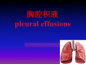 胸腔积液.ppt