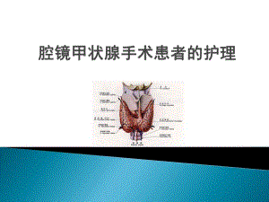 腔镜甲状腺手术.ppt