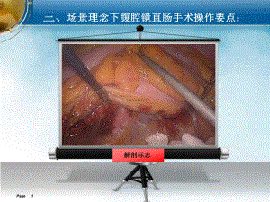直肠的局部解剖与腹腔镜“场景”理念下的手术操作技巧（2） .ppt