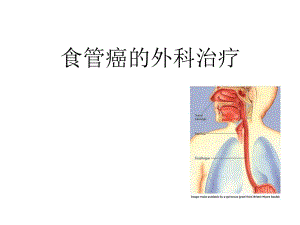 食管癌的外科治疗幻灯片[1].ppt