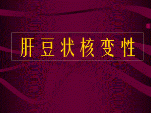 肝豆状核变性(PPT34).ppt