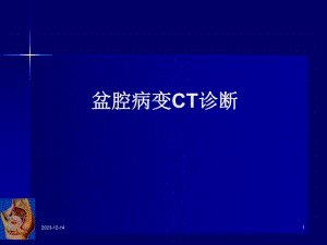 女性生殖系统疾病CT诊断.ppt