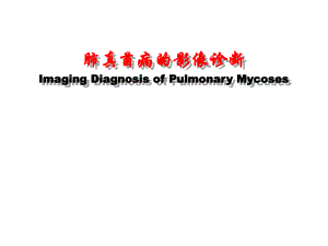 医院肺真菌病的影像诊断4.ppt
