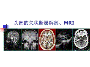 头部的矢状断层解剖应用.ppt